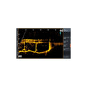 Lowrance HDS 12 Live Sonar with ActiveTarget 2 Transducer